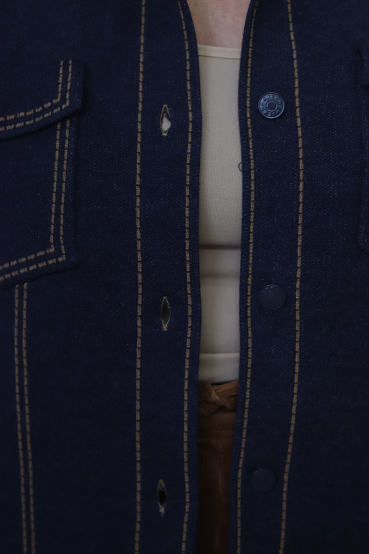 Casey Button Jacket