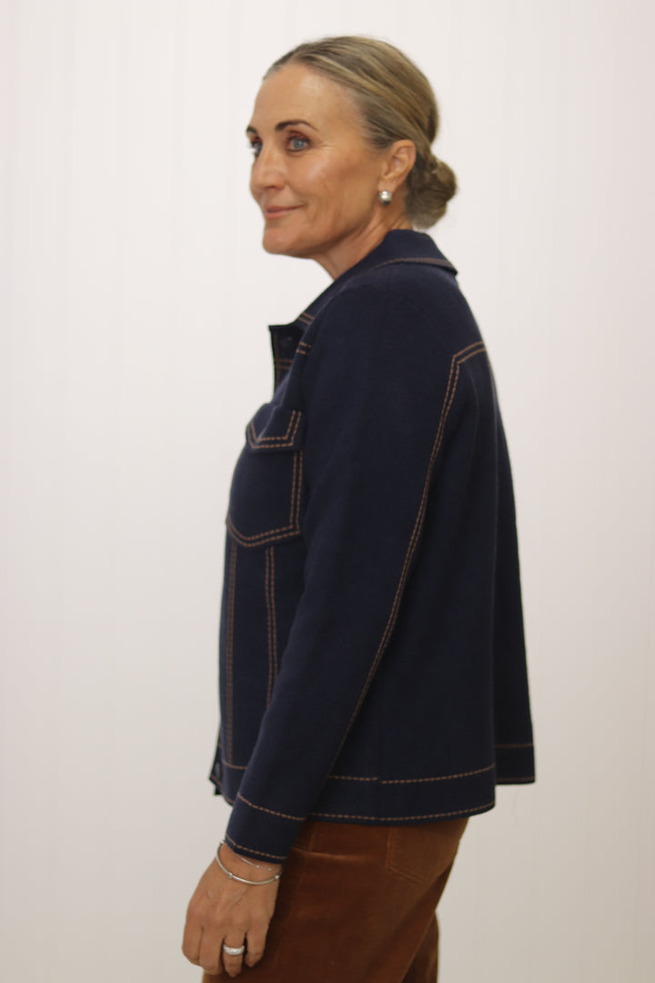 Casey Button Jacket